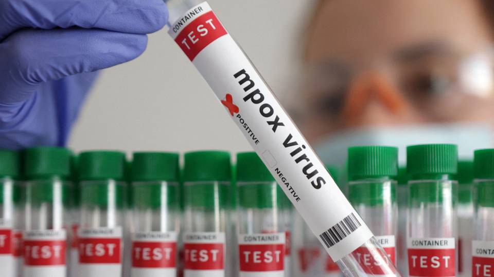 Mpox infections in DRC 'stagnating': WHO