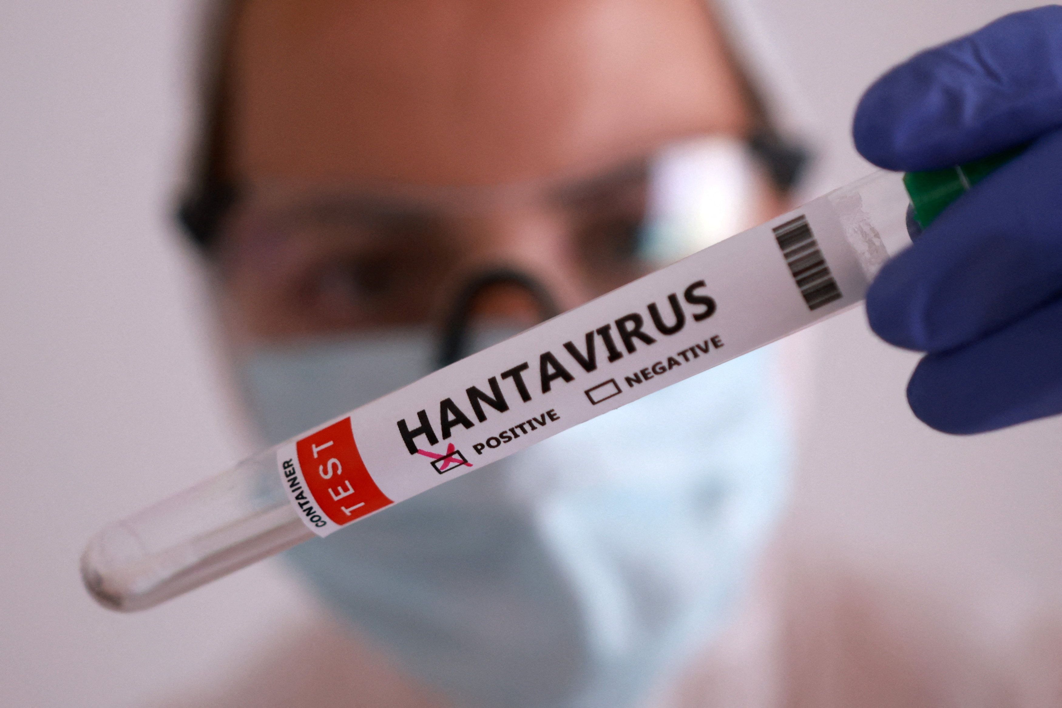 South Africa monitors four possible hantavirus contacts in Cape Town
