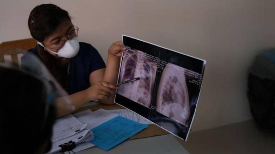 How a new therapy promises to tackle tuberculosis scourge
