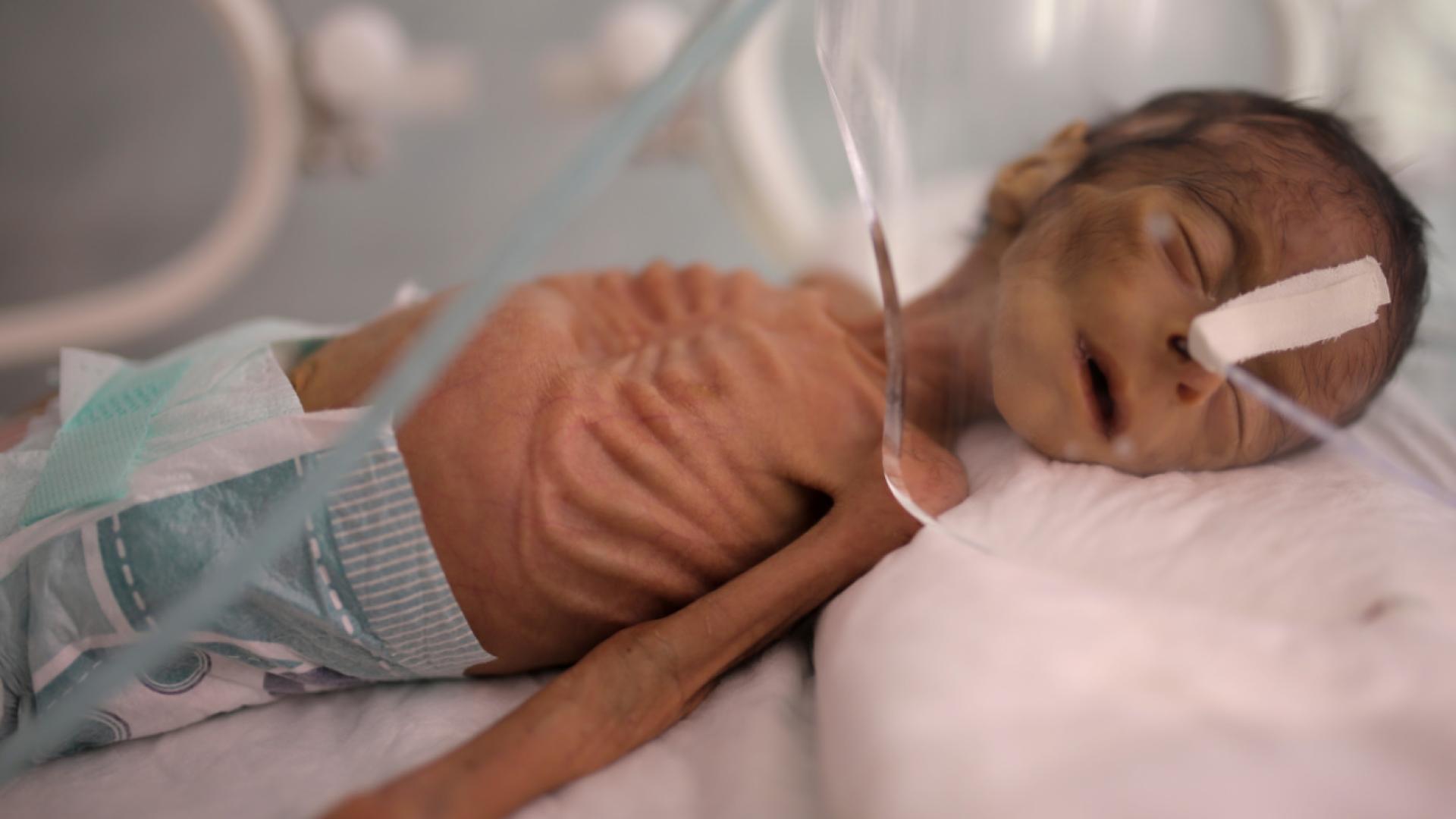 Mortalité infantile : 4,9 millions d’enfants décédés en 2024