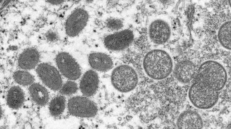 What’s Mpox and why is the world worried about it?