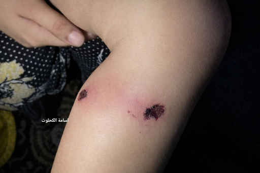 Rahoto ya zargi sojojin Isra’ila da azabtar da jariri a Gaza