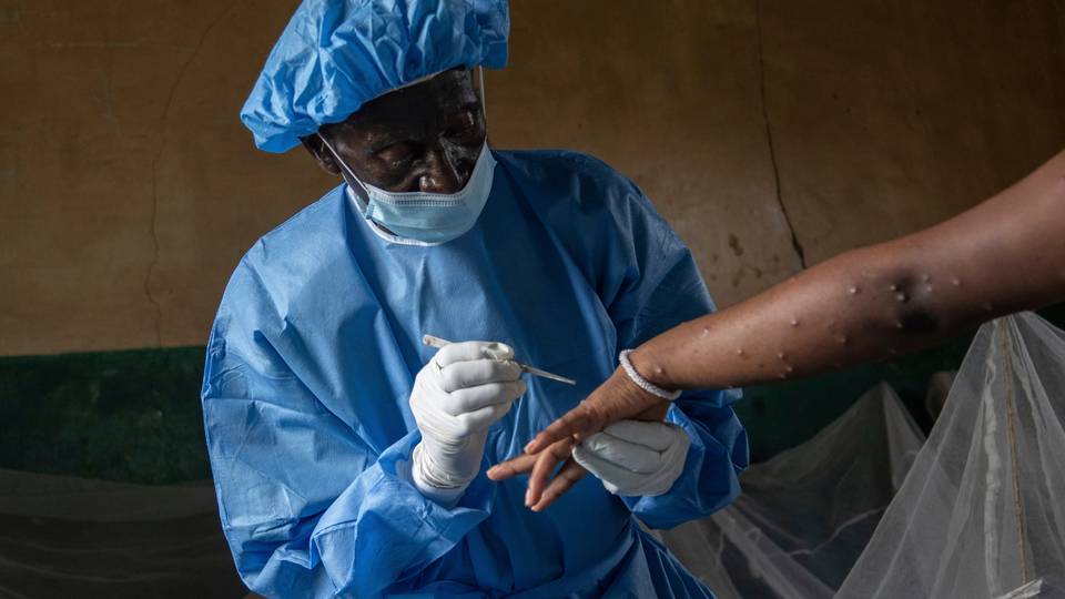 DR Congo finally begins mpox vaccinations