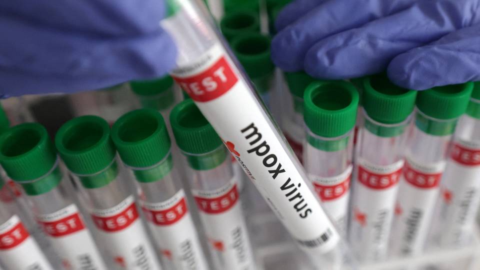 Mpox: Uganda reports rise in cases of more deadly strain