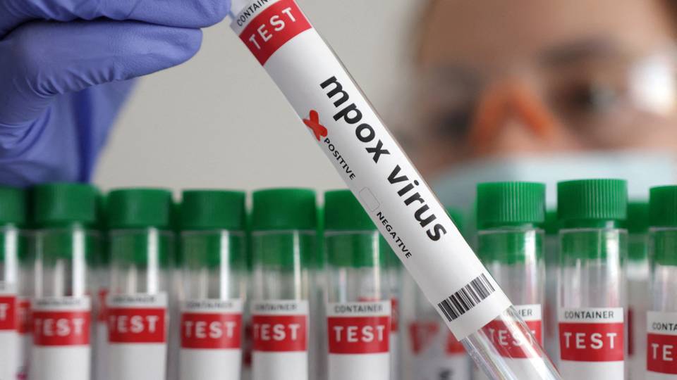 Mpox: Ugandan prisoner isolated after virus detected