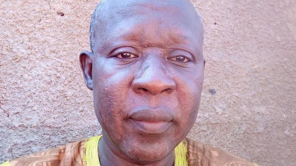 Ranar Ciwon Siga ta Duniya: 'Yadda cutar ta sa aka yanke min kafa'