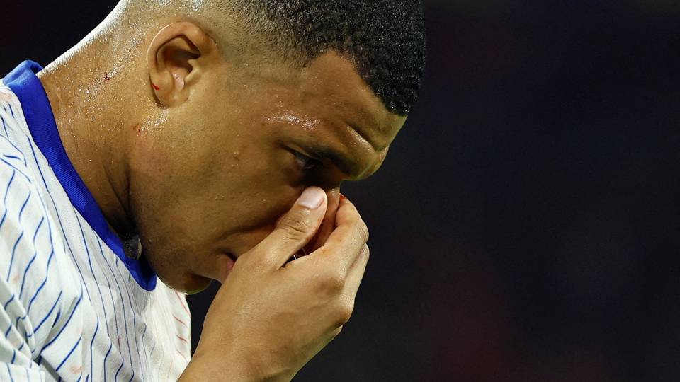 Euro2024 : inquiétude pour Mbappé, touché au nez