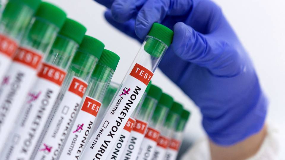 Mpox not new COVID, says WHO