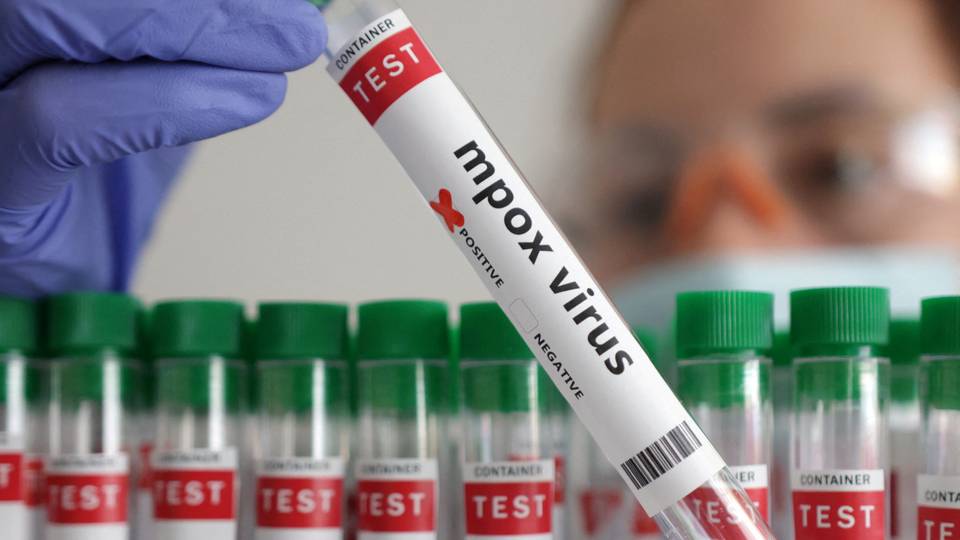 Africa CDC confident to raise $600m for mpox response