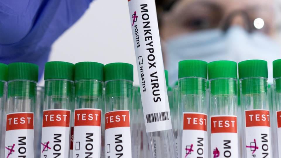 Africa could start mpox vaccinations 'within days'