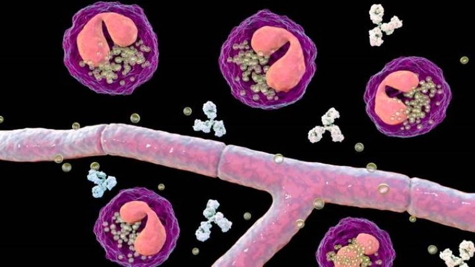 Maladies rares : les défis posés aux patients, aux médecins et aux décideurs politiques