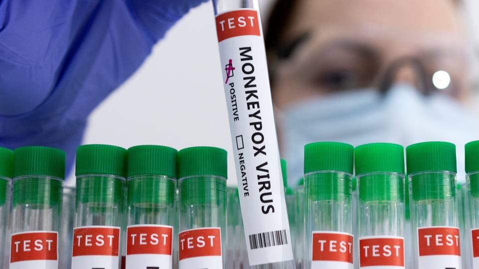 Nigeria starts mpox vaccination