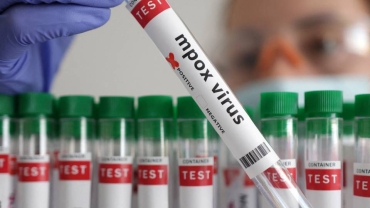 Zimbabwe reports its first two cases of mpox