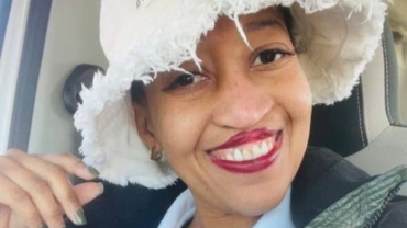 Seitebogo : une militante sud-africaine contre la fente labiale dont la cicatrice est essentielle à son identité