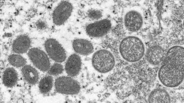 Pakistan, Sweden record first deadly mpox strain virus cases
