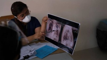 How a new therapy promises to tackle tuberculosis scourge