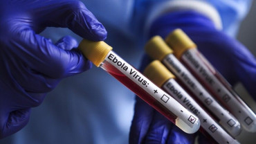 Ebola testing suspended in three Congo labs following supply shortages: WHO