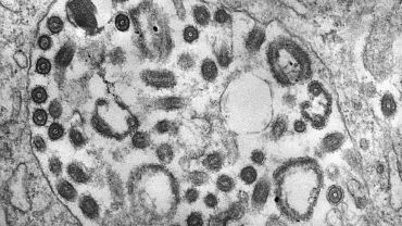 Rwanda confirms first cases of Ebola-like Marburg virus