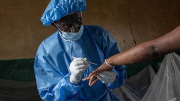 DR Congo finally begins mpox vaccinations