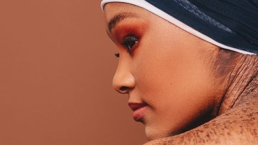 Zoey's triumph: Beauty beyond skin and stigma