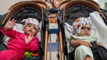Story of hope: Turkish doctors separate conjoined twin babies from Pakistan