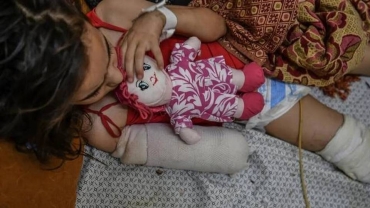 Every day, 10 Gaza children lose one or both legs due to Israel's war — UN