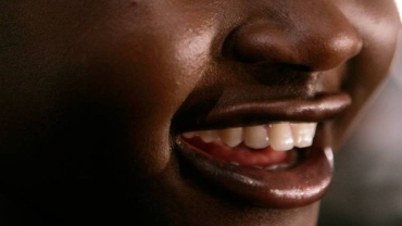 La technologie à l'origine du coût élevé des implants dentaires en Tanzanie